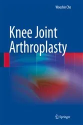 Book cover of Knee Joint Arthroplasty by Wooshin Cho