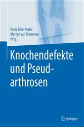 Book cover of Knochendefekte und Pseudarthrosen by Peter Biberthaler