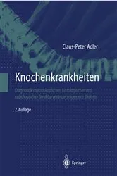 Book cover of Knochenkrankheiten (2nd ed.) by Claus-Peter Adler