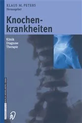 Book cover of Knochenkrankheiten by Klaus M. Peters