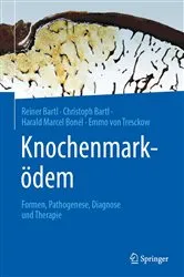 Book cover of Knochenmarködem by Reiner Bartl