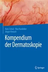 Book cover of Kompendium der Dermatoskopie by Hans Schulz