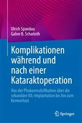 Book cover of Komplikationen während und nach einer Kataraktoperation by Ulrich Spandau