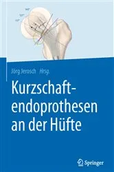Book cover of Kurzschaftendoprothesen an der Hüfte by Jörg Jerosch