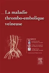 Book cover of La maladie thrombo-embolique veineuse by Collège Français de Pathologie Vasculair