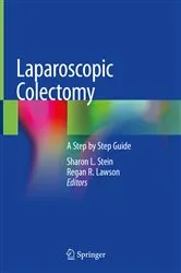Book cover of Laparoscopic Colectomy by Unknown
