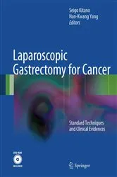 Book cover of Laparoscopic Gastrectomy for Cancer by Seigo Kitano