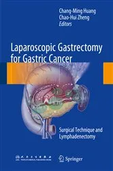 Book cover of Laparoscopic Gastrectomy for Gastric Cancer by Chang-Ming Huang