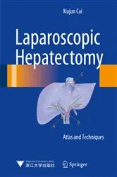 Book cover of Laparoscopic Hepatectomy by Xiujun Cai