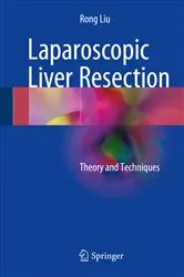Book cover of Laparoscopic Liver Resection by Rong Liu