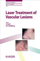 Book cover of Laser Treatment of Vascular Lesions by S. Bard