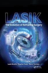 Book cover of LASIK by Lucio Buratto