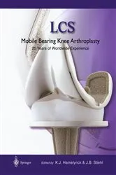 Book cover of LCS® Mobile Bearing Knee Arthroplasty by Karel J. Hamelynck