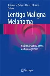 Book cover of Lentigo Maligna Melanoma by Kishwer S. Nehal