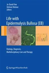 Book cover of Life with Epidermolysis Bullosa (EB) by Jo-David Fine