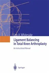 Book cover of Ligament Balancing in Total Knee Arthroplasty by Leo A. Whiteside