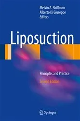 Book cover of Liposuction (2nd ed.) by Melvin A. Shiffman