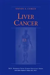 Book cover of Liver Cancer by Steven A. Curley