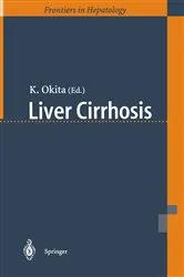 Book cover of Liver Cirrhosis by K. Okita