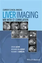 Book cover of Liver Imaging by Ersan Altun