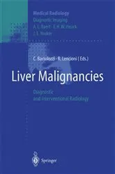 Book cover of Liver Malignancies by C. Bartolozzi