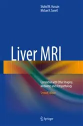 Book cover of Liver MRI (2nd ed.) by Shahid M. Hussain
