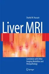 Book cover of Liver MRI by Shahid M. Hussain
