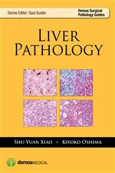 Book cover of Liver Pathology by Kiyoko Oshima