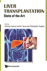 Book cover of Liver Transplantation: State Of The Art by Abhinav Humar