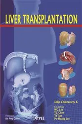 Book cover of Liver Transplantation by Unknown