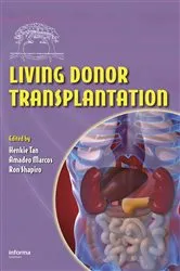 Book cover of Living Donor Transplantation by Henkie P. Tan