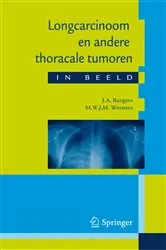 Book cover of Longcarcinoom en andere thoracale tumoren in beeld by Unknown