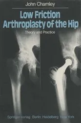 Book cover of Low Friction Arthroplasty of the Hip by J. Charnley