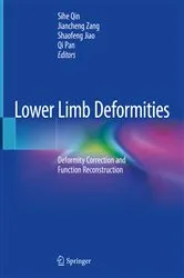 Book cover of Lower Limb Deformities by Sihe Qin