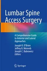 Book cover of Lumbar Spine Access Surgery by Joseph R. O'Brien