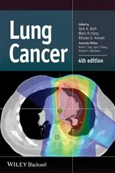 Book cover of Lung Cancer (4th ed.) by Jack A. Roth