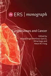 Book cover of Lung Diseases and Cancer by Miguel Angel Martinez-Garcia