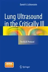 Book cover of Lung Ultrasound in the Critically Ill by Daniel A. Lichtenstein