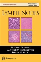 Book cover of Lymph Nodes by Alexandra Harrington