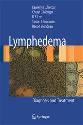 Book cover of Lymphedema by Jeannie Burt