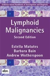 Book cover of Lymphoid Malignancies by Estella Matutes