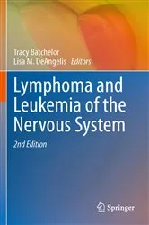 Book cover of Lymphoma and Leukemia of the Nervous System by Tracy Batchelor