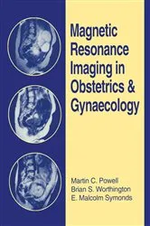 Book cover of Magnetic Resonance Imaging in Obstetrics and Gynaecology by Martin C. Powell
