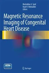 Book cover of Magnetic Resonance Imaging of Congenital Heart Disease by Mushabbar A. Syed