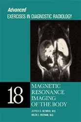 Book cover of Magnetic Resonance Imaging of the Body by Jeffrey C. Weinreb
