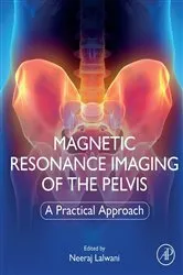 Book cover of Magnetic Resonance Imaging of The Pelvis by Neeraj Lalwani