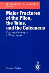 Book cover of Major Fractures of the Pilon, the Talus, and the Calcaneus by Harald Tscherne