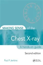 Book cover of Making Sense of the Chest X-ray (2nd ed.) by Paul Jenkins