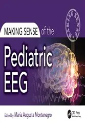 Book cover of Making Sense of the Pediatric EEG by Maria Montenegro