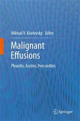 Book cover of Malignant Effusions by Unknown